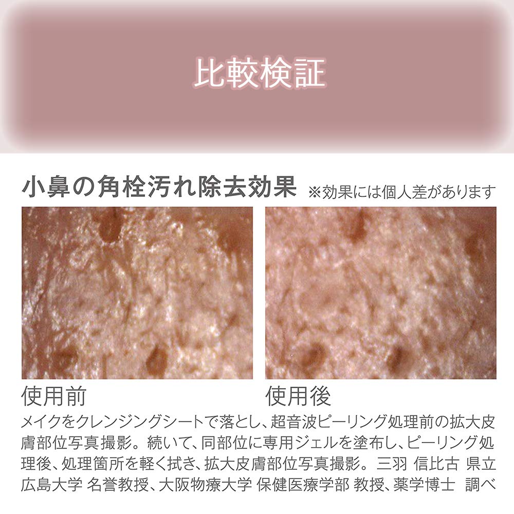 Koizumi Ultrasonic Peeling, Removes Sebum and Blackheads, Pink, KBE-2710/P