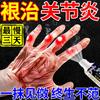 Finger Arthritis, Pain, Swelling, Difficulty Bending, Stiffness and Deformation, Finger Joints, Pain Relief, Special Ointment