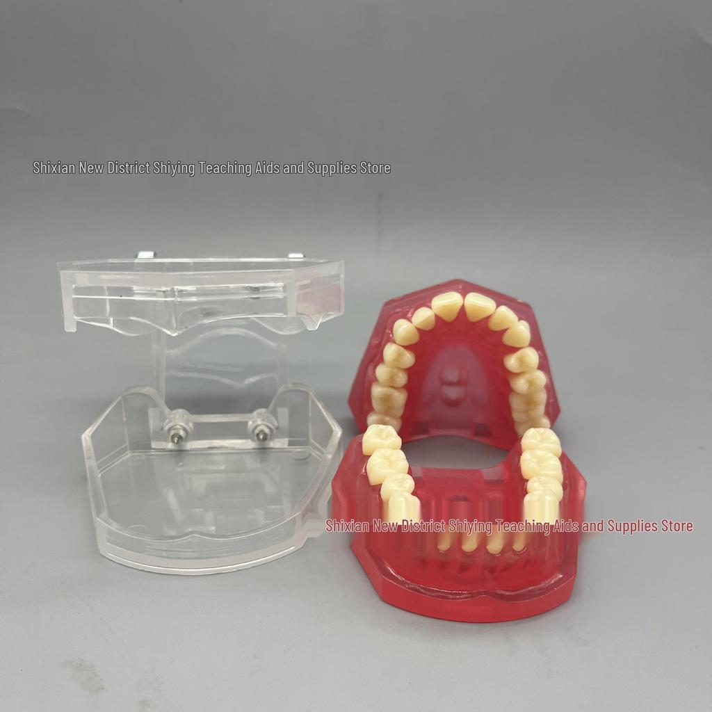 Transparent Dental Extraction Model with Removable Teeth and Soft Gums