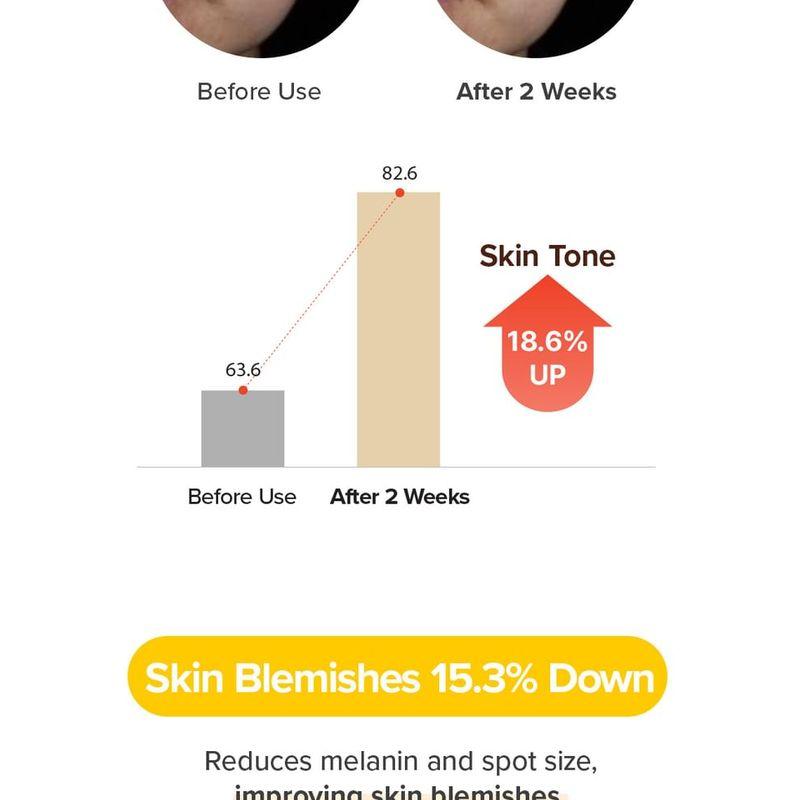 Mary&May - Rice Niacin 10% Triple Vitamin Serum Seoul Edition