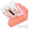 Teeth Model Dental Implant Analysis Crown Bridge Model Demonstration Tooth Model
