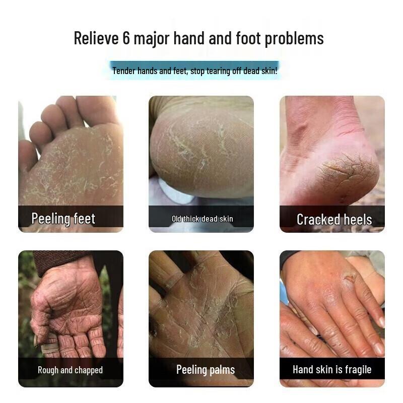 Longliqi Snake Oil Fruit Acid Hand Cream