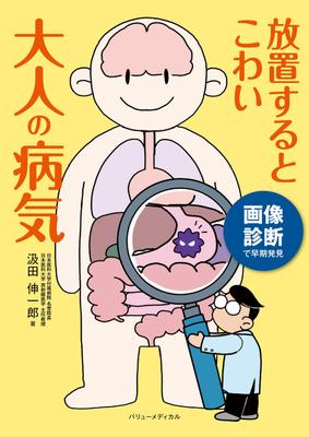 Früherkennung durch bildgebende Diagnostik: Krankheiten bei Erwachsenen, die unbehandelt gefährlich sein können