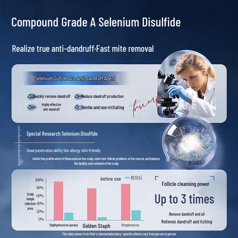 Vithair Selenium Sulfide Anti-Dandruff Shampoo