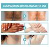 Spot Remover For Body,Spot Corrector Cream,- Underarm, Neck, Armpit, Knees, Elbows, Private Areas, Intimate Areas