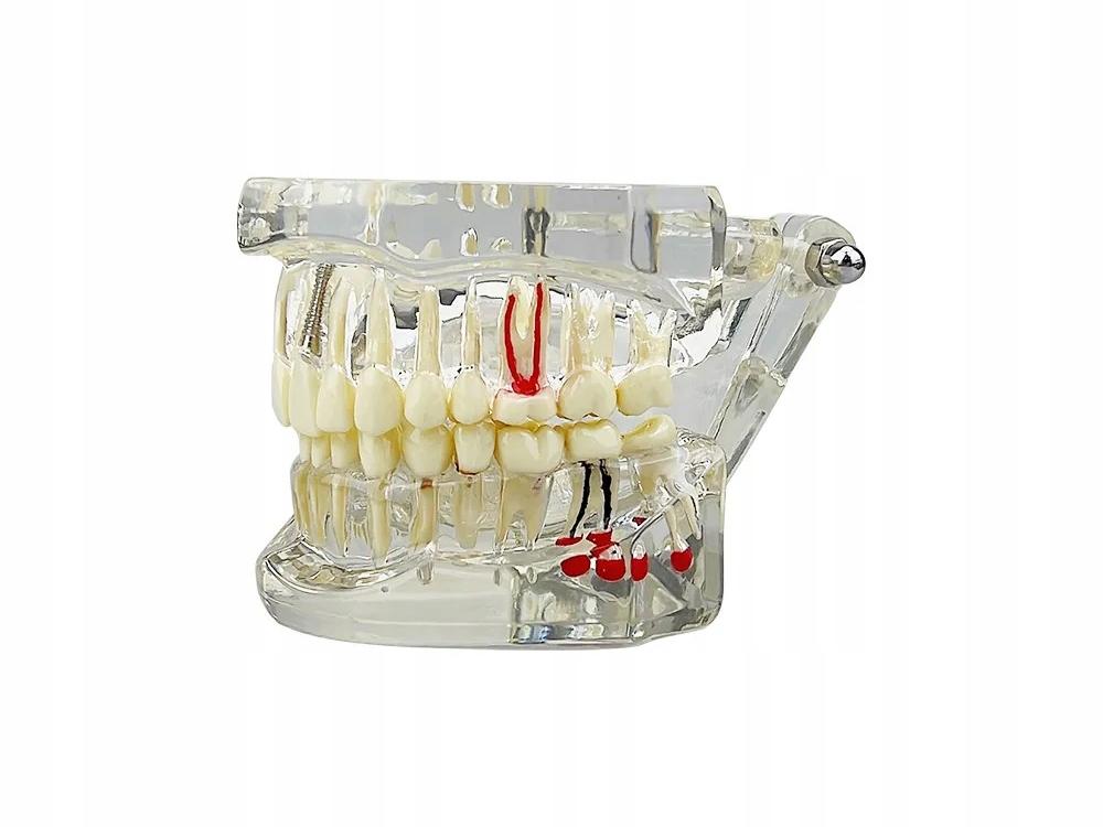 Dental Model 2 White (100) Gab_B