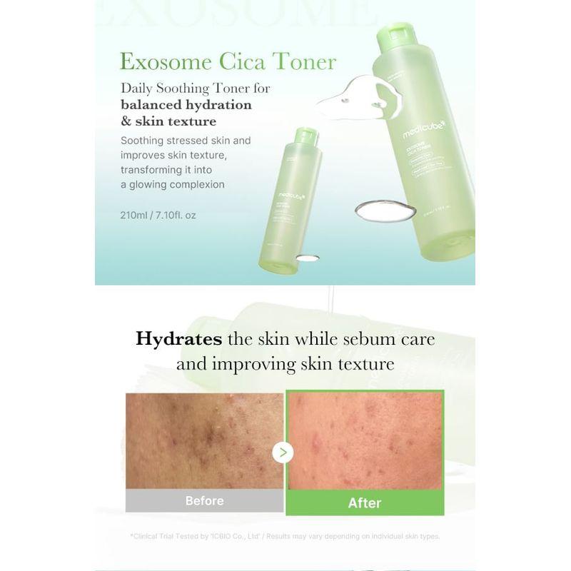 medicube - Exosome Cica Toner