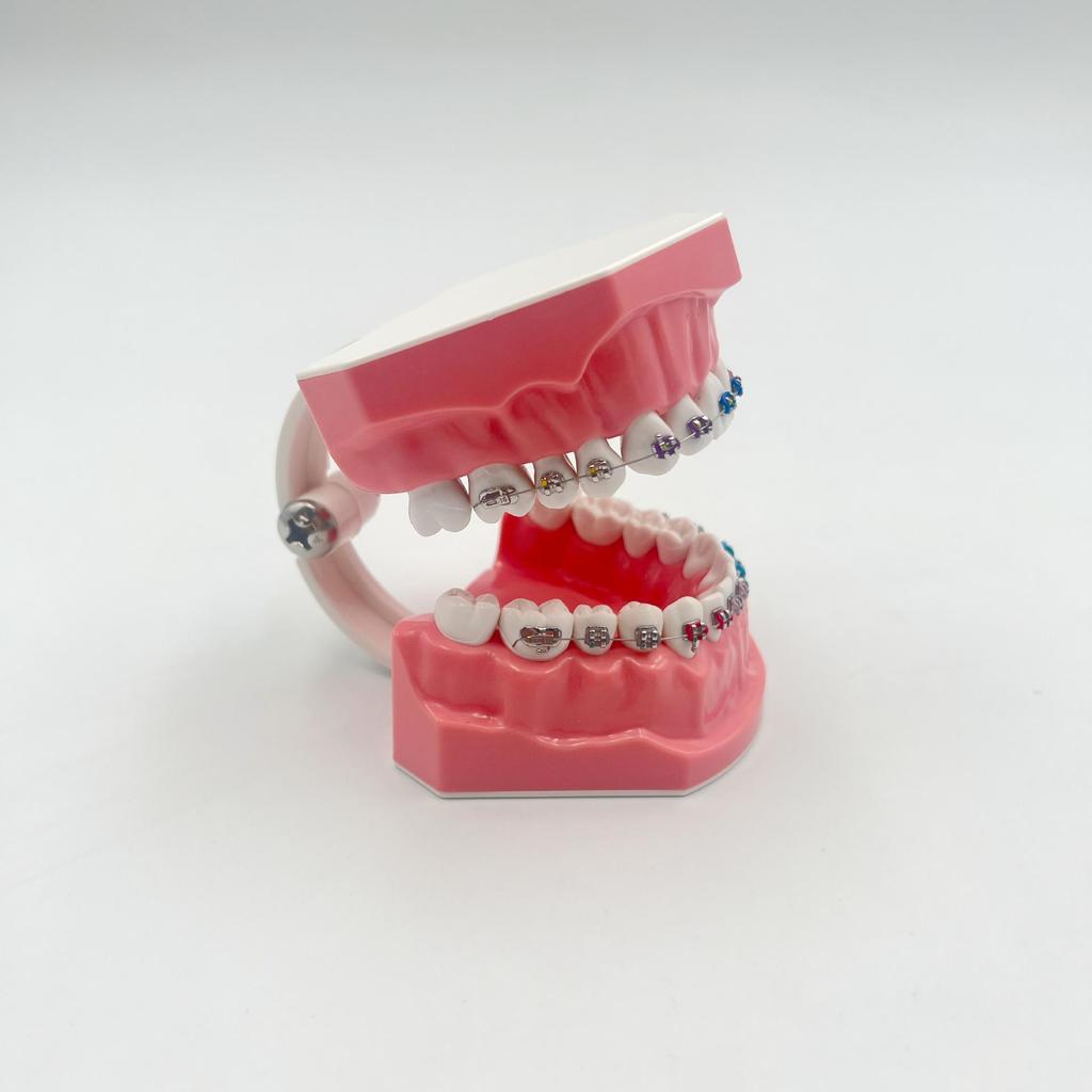 Modelo Dental No Extraíble con 28 Dientes