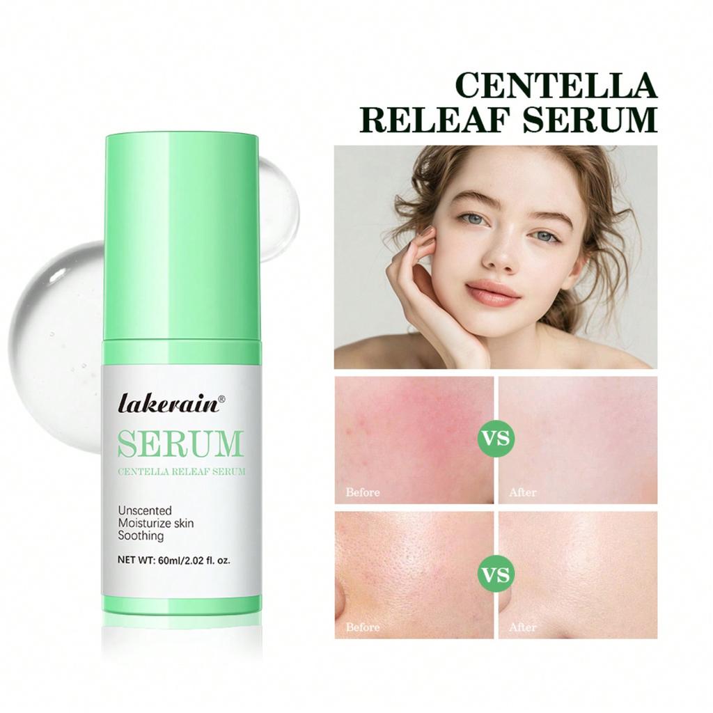 1 Centella Asiatica Soothing Essence 60 Ml Soothes The Skin Barrier Gentle Skin Care Repairs The Skin Moisturizes and Soothes The Skin