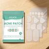 EELHOE Hydrocolloid Acne Patches Pimple Removal Smoothing Skin Repair Blemish Care Invisible Breathable Pimple Patch 132 Patches