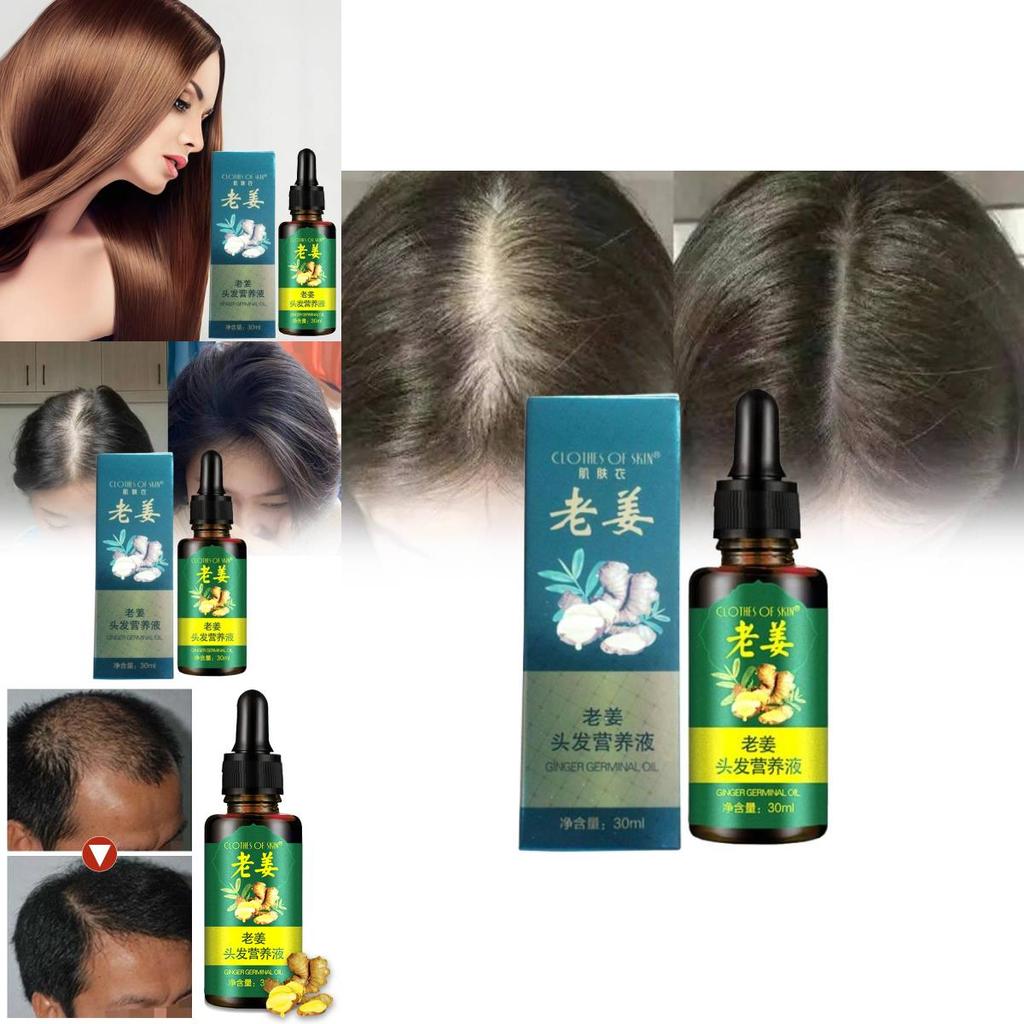 Nourishing Ginger Hair Essence For Healthy And Shiny Locks With Oil Control Benefits