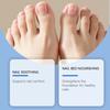Nail Care Patches, Nail Care Correction Patches, Home Foot Patches, Comfortable And Suitable Nail Correction.
