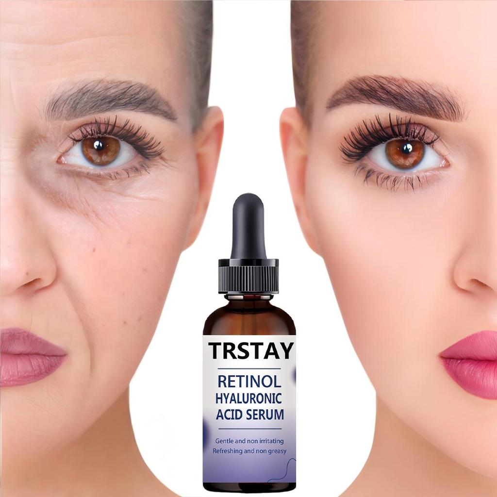 Krém na bělení pih Efektivní odstranění melasmy Krém na tmavé skvrny Vyblednutí Hydratační Rozjasnění Hladká krása Péče o pleť