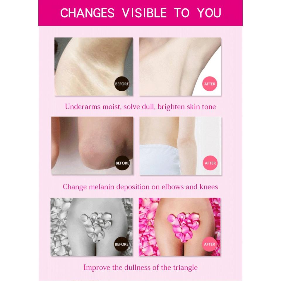 aichunArmpit cream, armpit brightening and hydrating cream, refreshing and non-greasy, body care cream, a whitening and moisturizing wonder