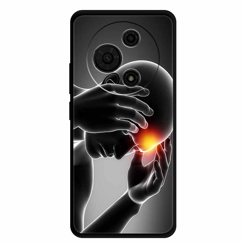 For TCL 605 Case 6.7” Cartoon Animal Shockproof Silicone Soft TPU Funda For TCL 605 Back Cover Protective Nubia Coque Military