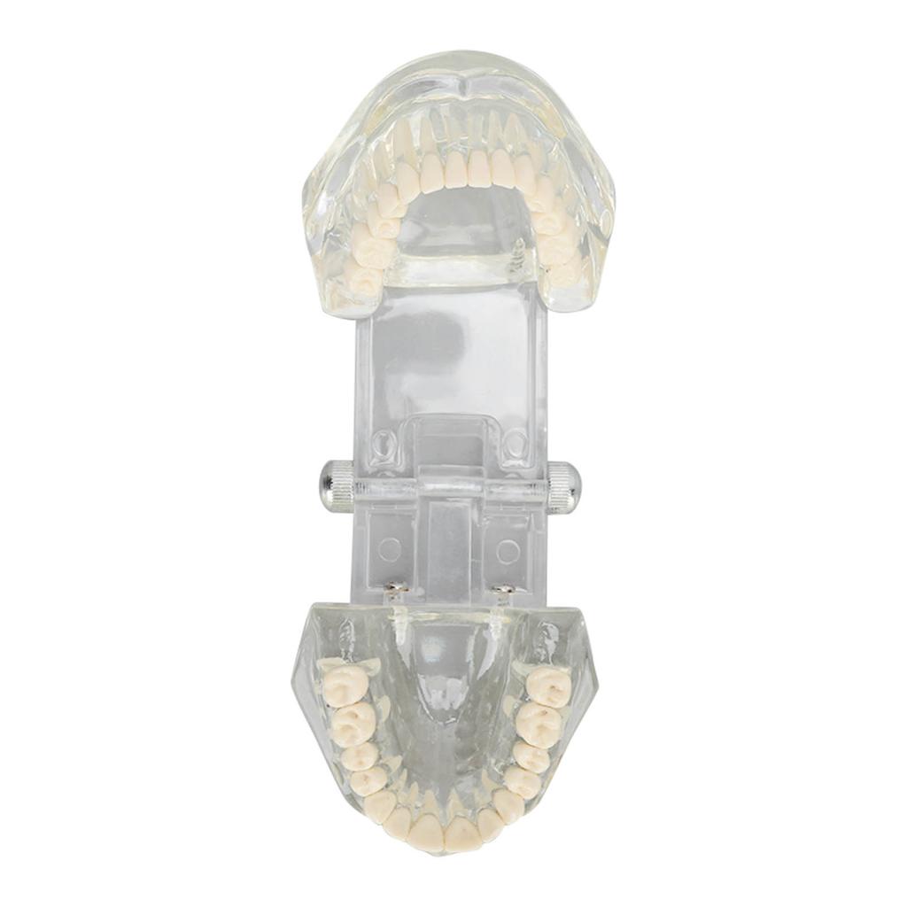 Transparent Dental Model Clear Structure Educational Dental Teeth Display Model for Dental Clinic