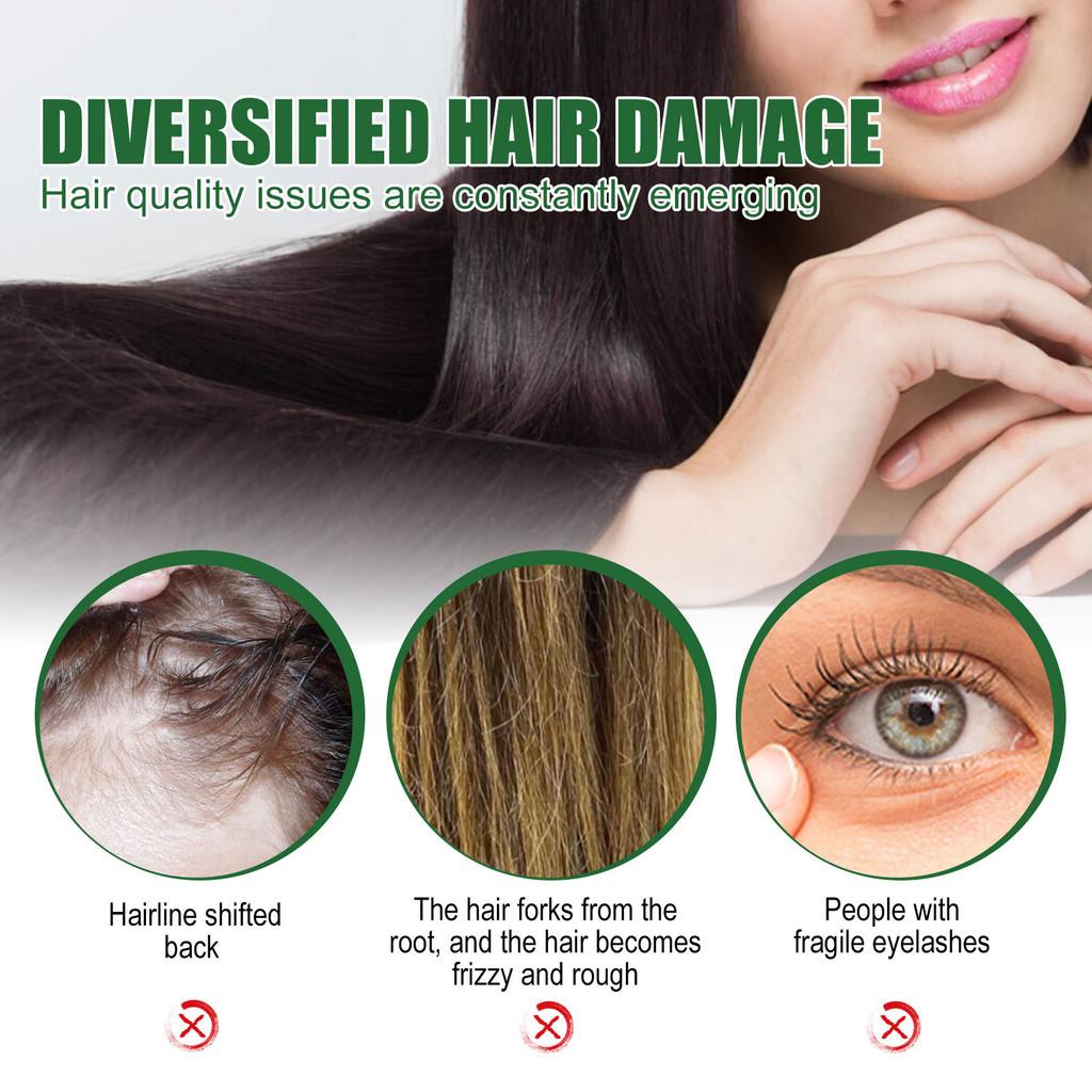 Eelhoe Castor Oil Hair Growth Serum Rich Nourishing Scalp Massage Treatment 60ml Set