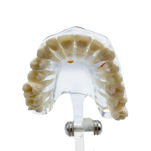 Dental Educational Model, Zamo®, Used To Exemplify Dental Pathologies, 31 Teeth, Transparent