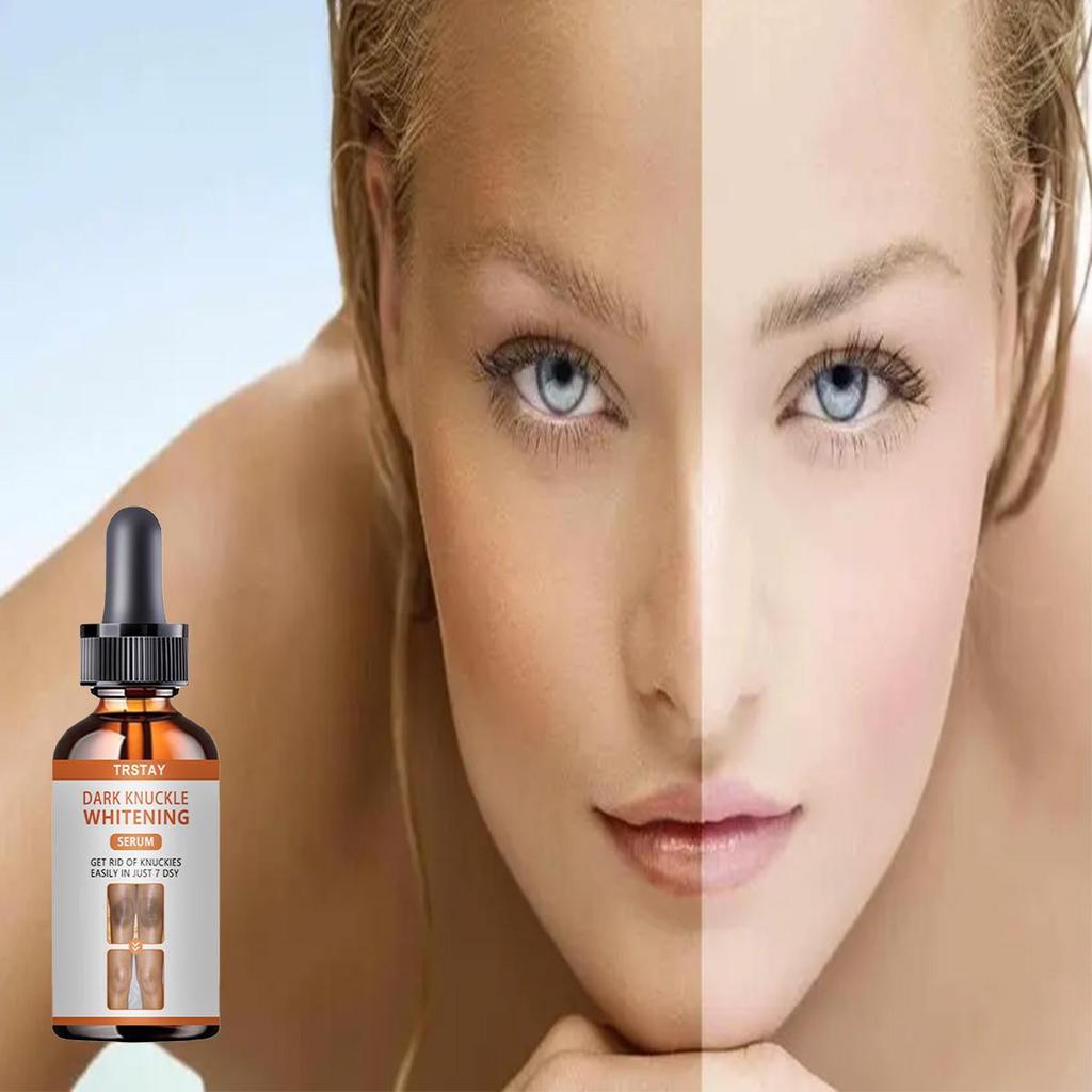 Whitening Freckles Cream Remove Melasma Dark Spot Lightening Melanin Brightening Melasma Remover Moisturize Anti-aging Face Care