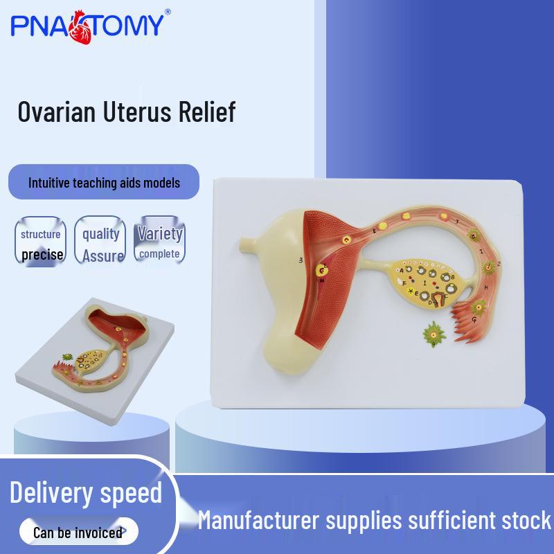 Human Uterus & Ovary Relief Model for Teaching Demonstration 23x18x5 cm