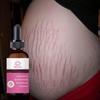 Stretch Mark Cream Scar Cream Pregnancy Cream Maternity Cream 30ml Scar Removal Repair Cream Repairs Firming Skin