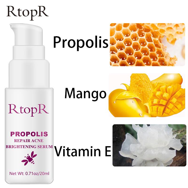 Propolis Reparasjon Akne Lysende Serum Akne Arr Flekker Rengjøring Serum Krympe porene Eliminerer Akne Behandling Oljekontroll