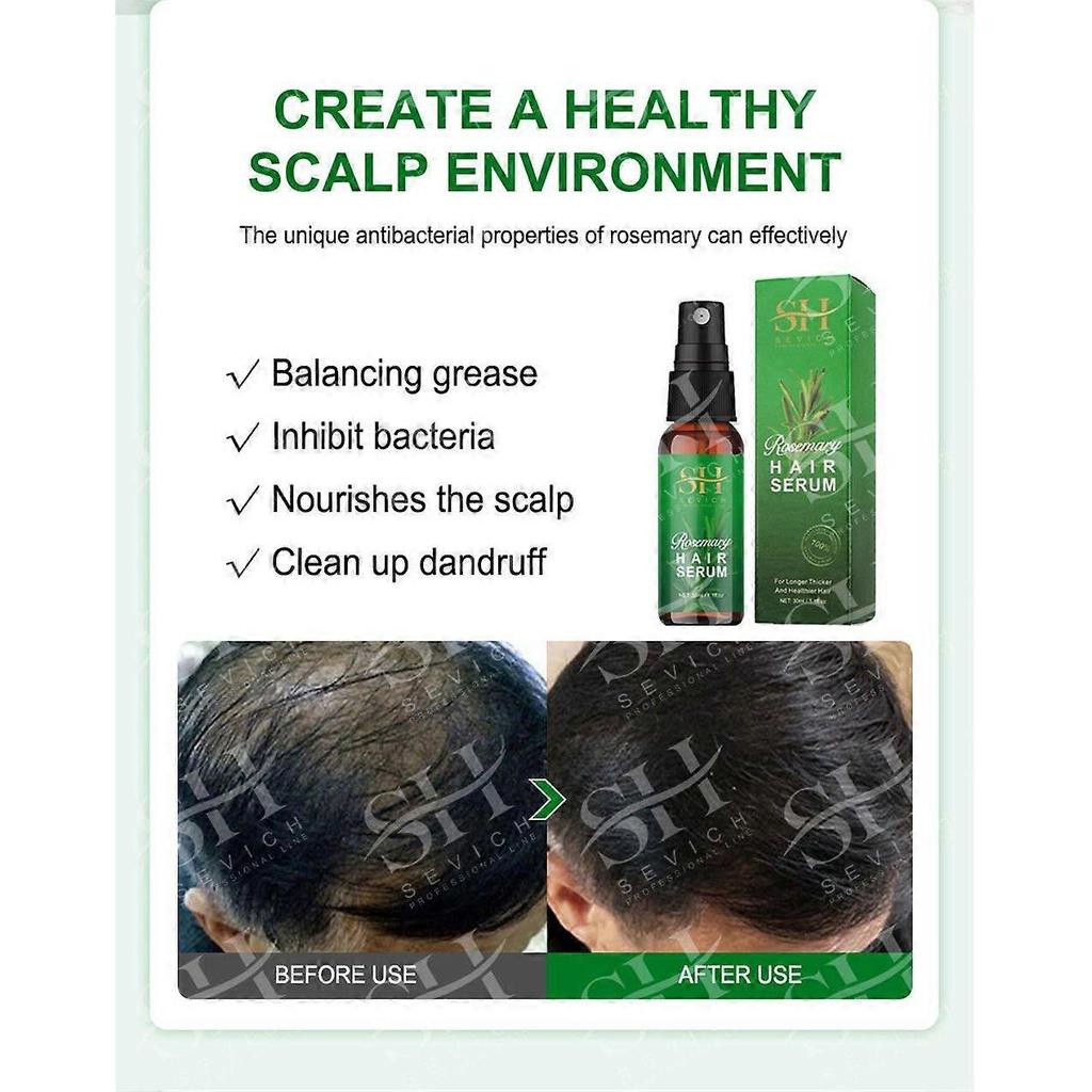 3pcs Rosemary Essential Oil Pure Natural Nourish Scalp Essential Oil Anti-Hair Loss Hair Growth