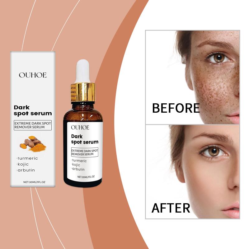 Radiant Nourishing Serum Spot Removal Fast Absorption Oil Water Balance Enhance Elasticity Suitable For Sensitive Skin
