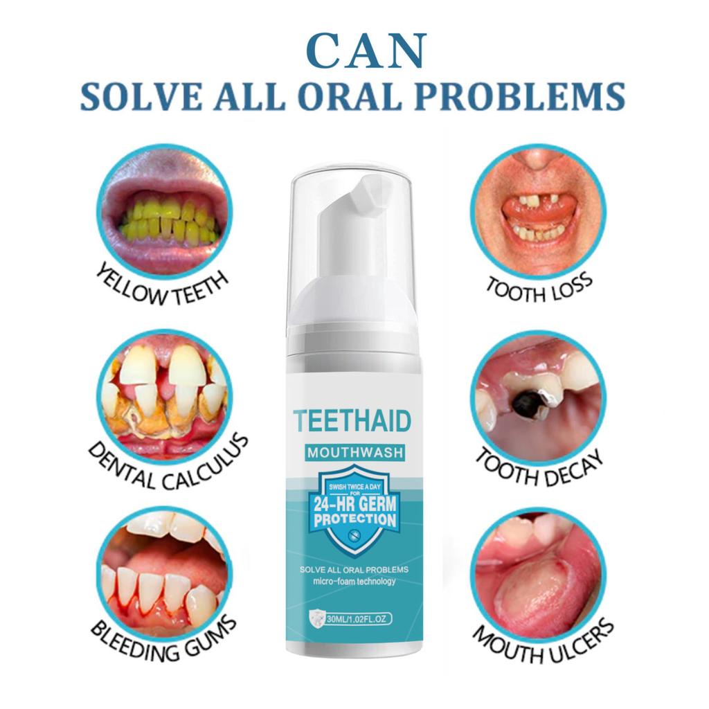 30ML Mousse Toothpaste Natural Ingredients Oral Care Food Grade User-friendly Teeth Mousse Foam