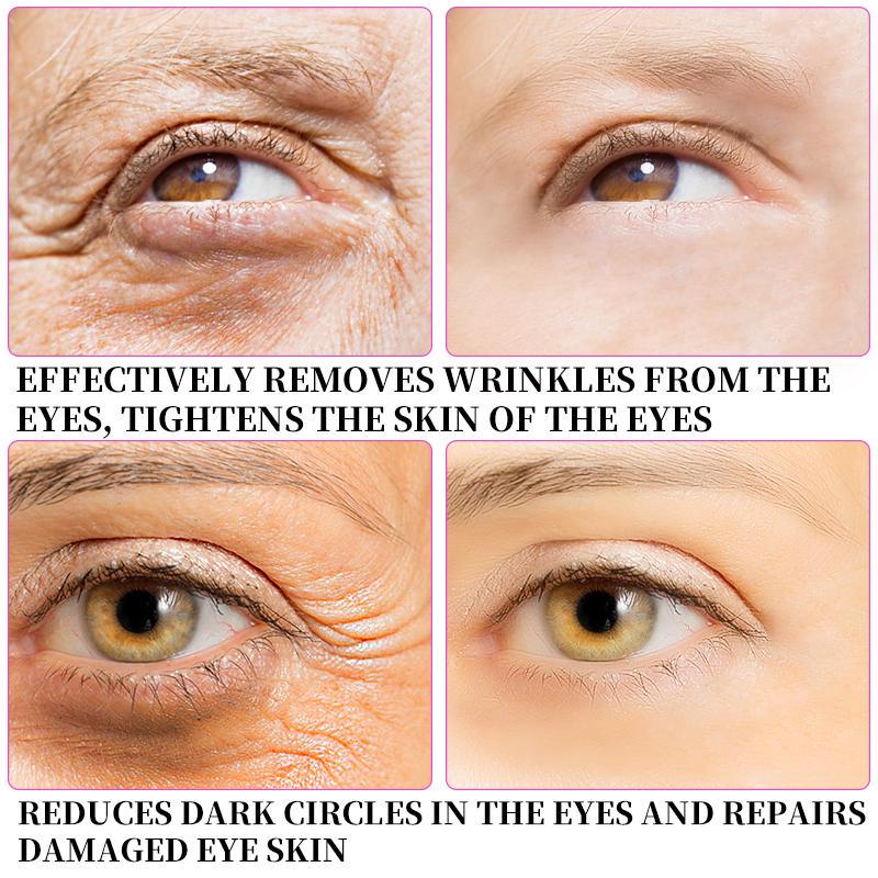 vitamin c under eyes