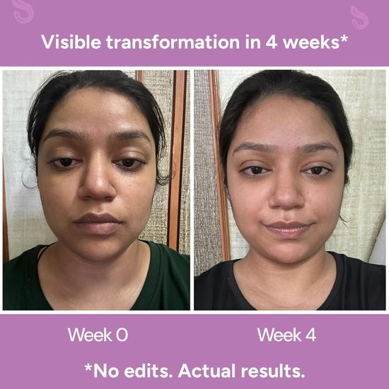 CITTA Regeneratives Gesichtsserum | Faltenlifting & Anti-Aging Nachtserum | Niacinamid & Kojisäure zur Faltenkorrektur | 30ml