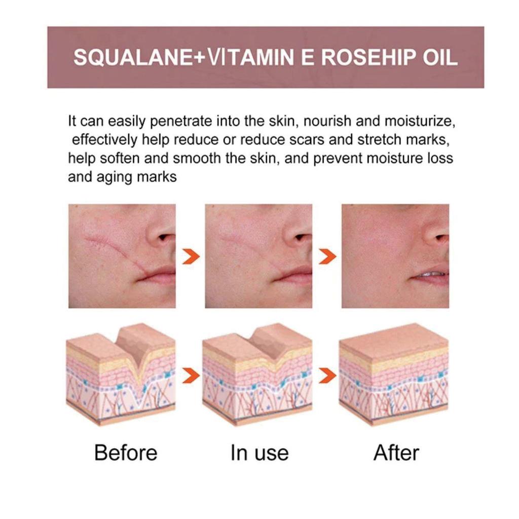 Scar Repair Cream Fade Post-scald Scar Moisturizing Repair Remove Cellulite Scar Cream