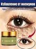 Remedy Against Milia (fat Granules) Around the Eyes, 30 G