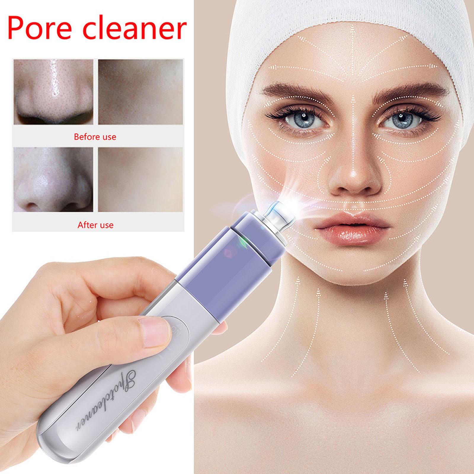 

Электрический Blackhead Remover Лицо Поре Cleaner Прыщ Удаление вакуумного всасывания