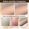 1/2Pcs 60ML Natural Cyperus Rotundus Oil Reducing Body Hair Growth Moisturizing Soothing Men Women Hair Removal Essential Oil