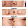 Brightening Cream for Melasma, Freckles, Sun & Age Spots - Fades Melanin & Dullness, Enhances Skin Tone