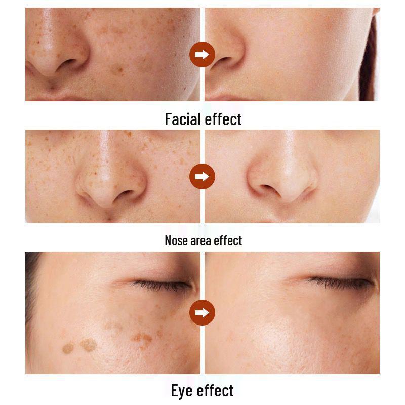 Brightening Cream for Melasma, Freckles, Sun & Age Spots - Fades Melanin & Dullness, Enhances Skin Tone
