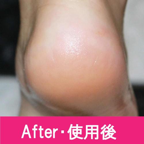 PERFECT NAILS Foot File, Waterproof, Callus Removal Tool for Heels and Bath (Red)