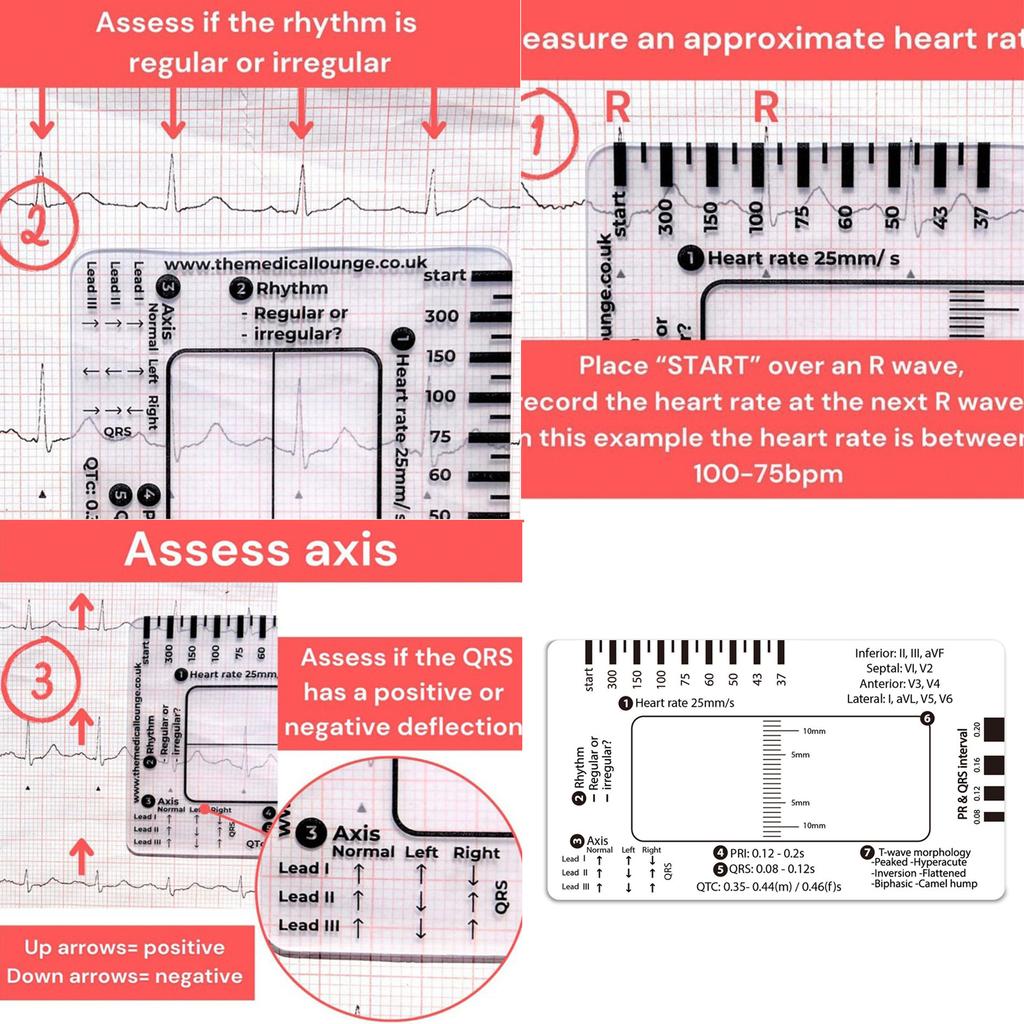 Professional ECG 7 Step Ruler Card Portable Pocket ECG Interpretation Guide Card For Accurate ECG/EKG Interpretation