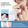 80Pcs/Set Acne Patches With Oil Ultra Thin Pimple Patch Acne Patch