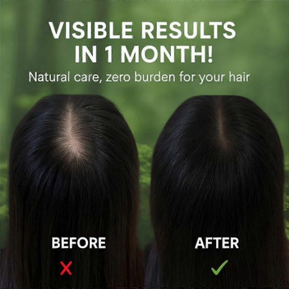 120g Herbal Hair Shampoo Bar, Mulberry Leaf, Usman Grass for Oil Control & Dandruff Treatment