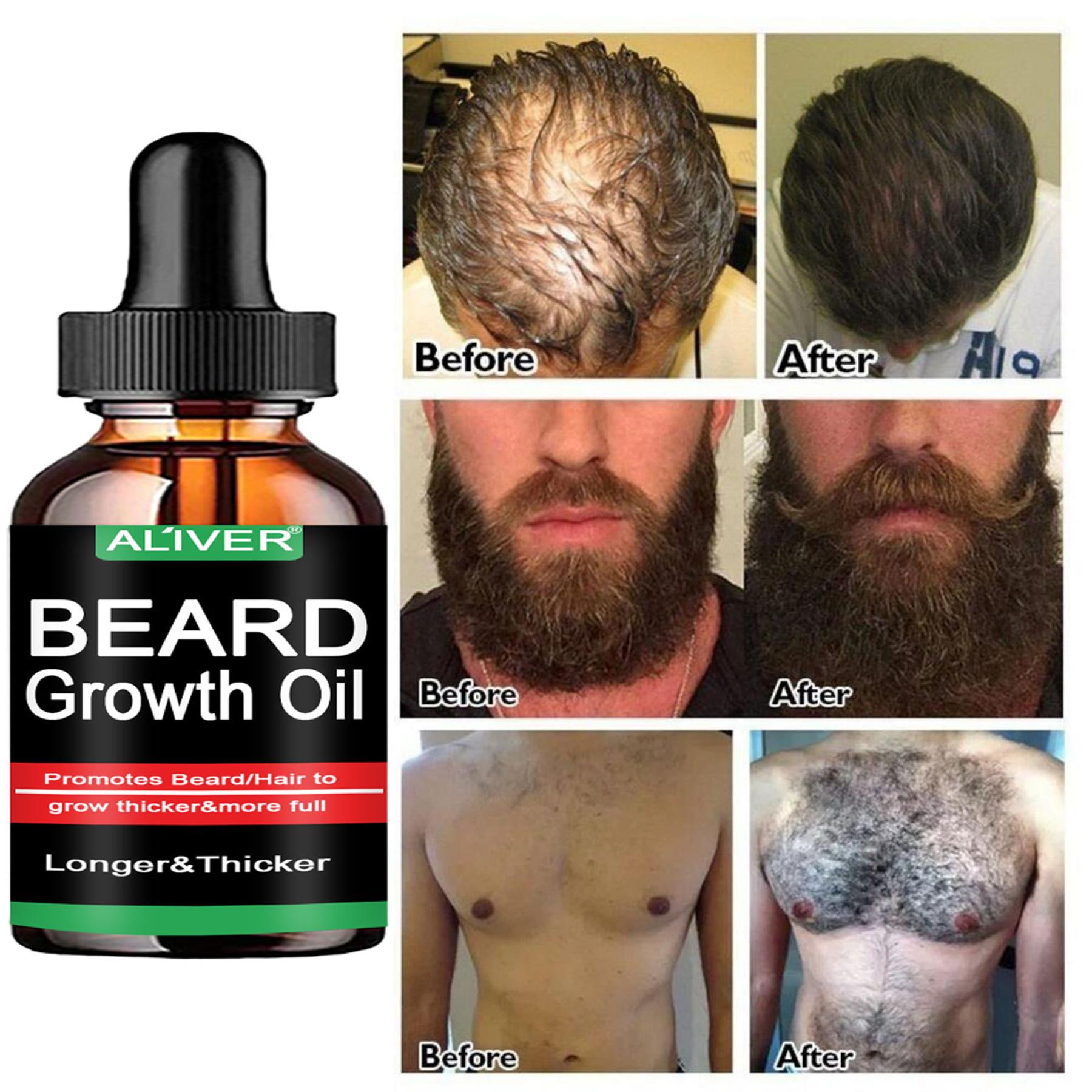 

Новинки Эфирные масла для роста бороды и груди. Длиннее и толще. Настоящий мужик