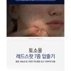 TOSOWOONG - Redspot Kit