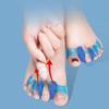 Toe Valgus Corrector Separator Hallux Bunions Finger Separator Toe Corrector Fingers Feet Haluksy toe Spreader Bunion Corrector