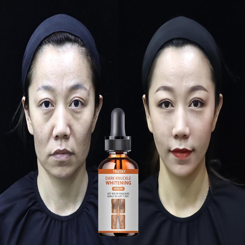 Collagen Complex Serum Face Blemish Skin Repair Essence Hydratační bělící zpevňující Zlepšení pružnosti obličeje Péče o pleť Ženy