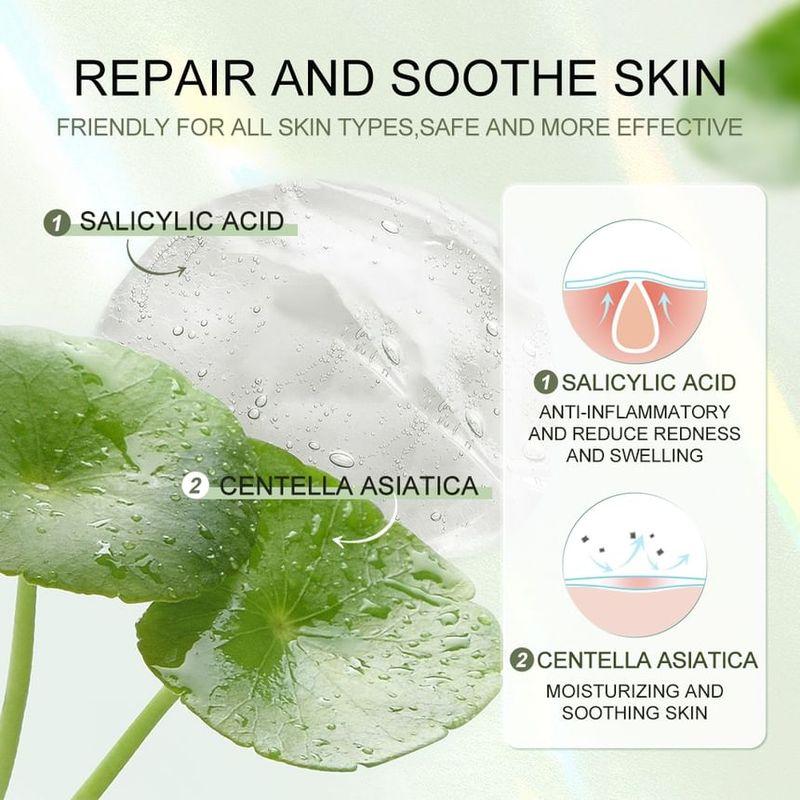 Sace Lady - Acne Patch