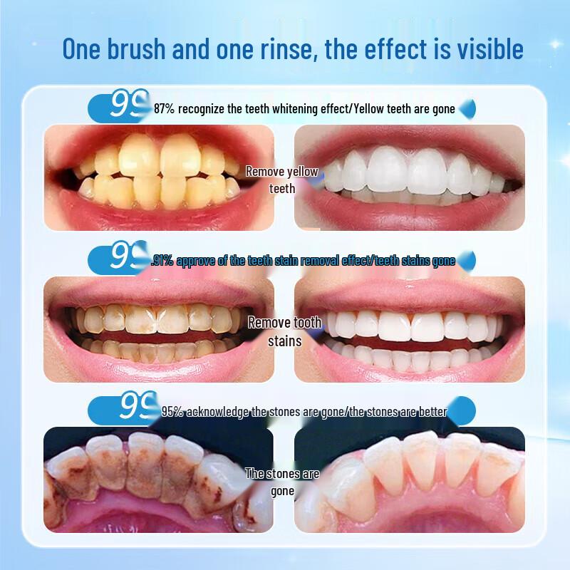 HIEUAILR Oral Care Collection