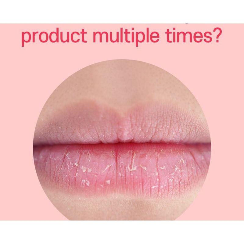 לְטַפֵּל:NEL - בלם תיקון גלוס שפתיים פירותי