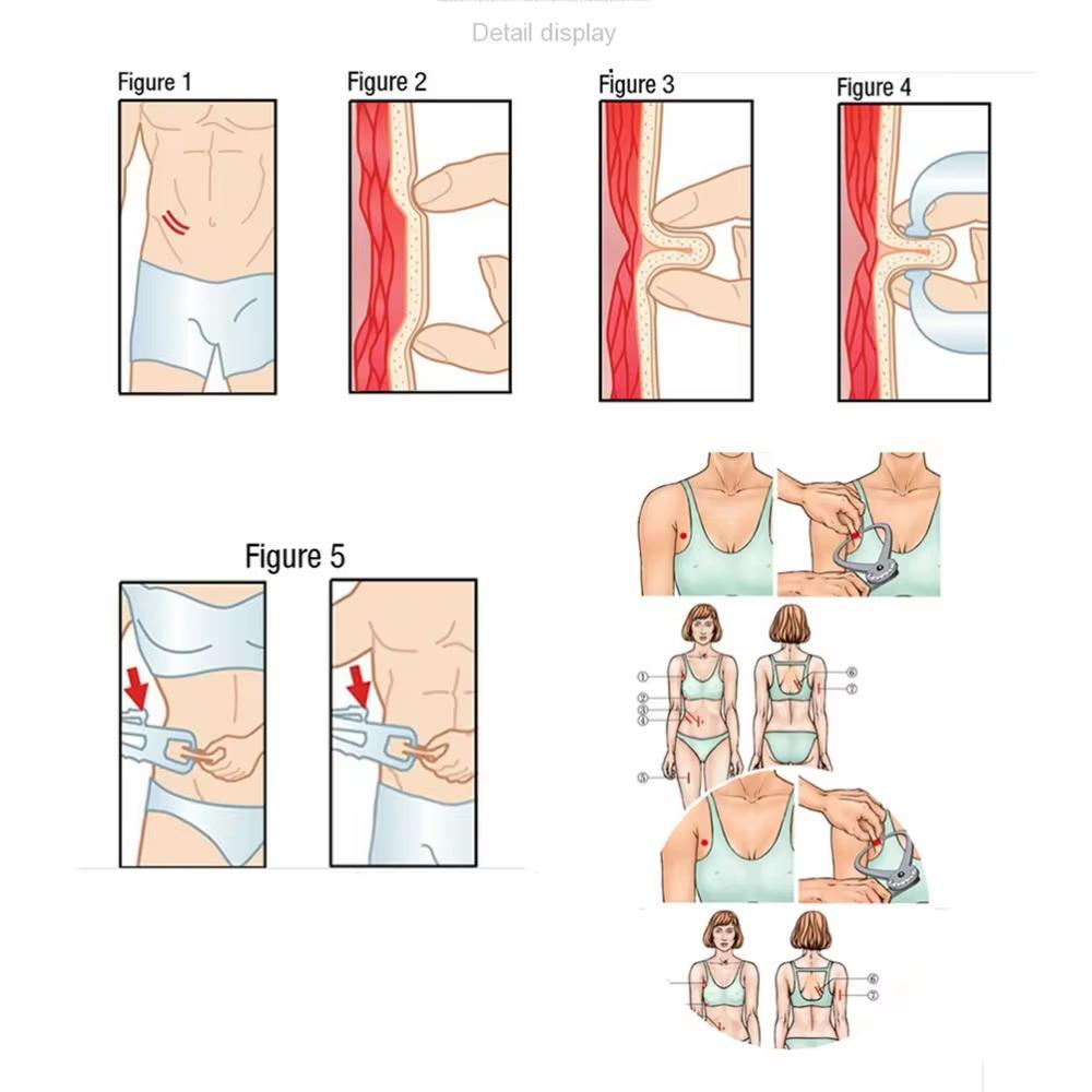 A Sebum Caliper Fat Clip Sebum Caliper Fat Thickness Measuring Ruler Body Fat Weight Loss Measuring Caliper Tape Measuring Tool