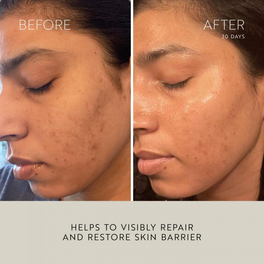 Katini Skin Celestial Nightly Skin Repair Oil Serum 1.7 Oz 50 Ml